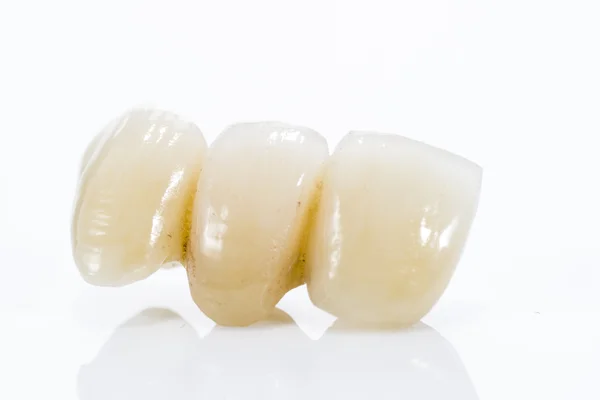 Protez dişler beyaz bir arka plan üzerinde makro