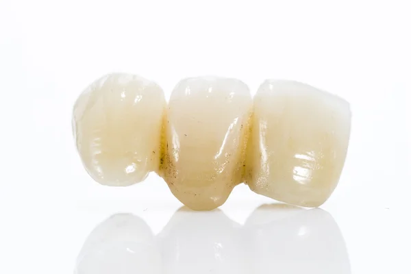 Macro of prosthetic teeth on a white background — Stock Photo, Image