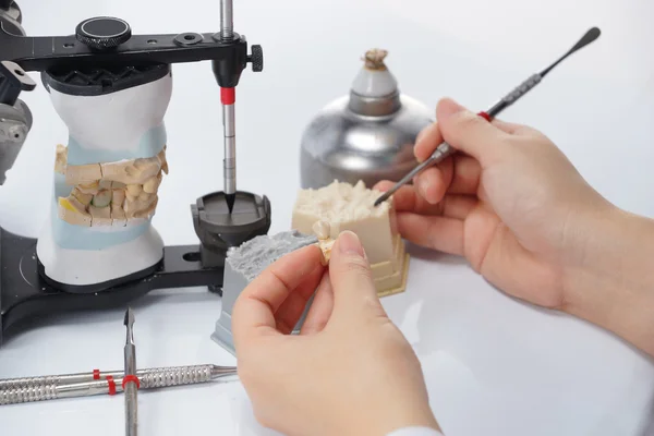 Dental technician working with articulator in dental laboratory — Stock Photo, Image