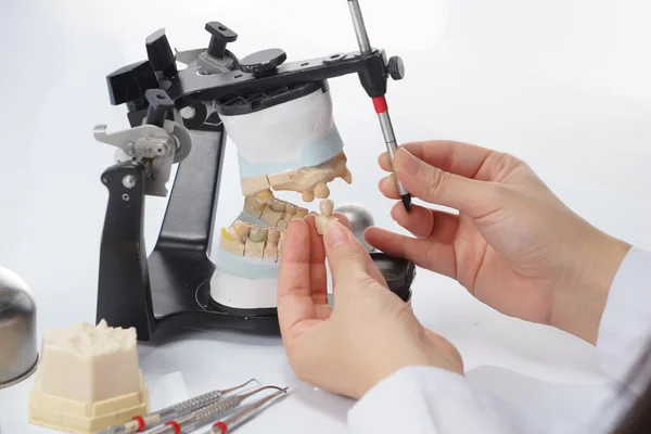 Técnico dental trabajando con articulador en laboratorio dental — Foto de Stock