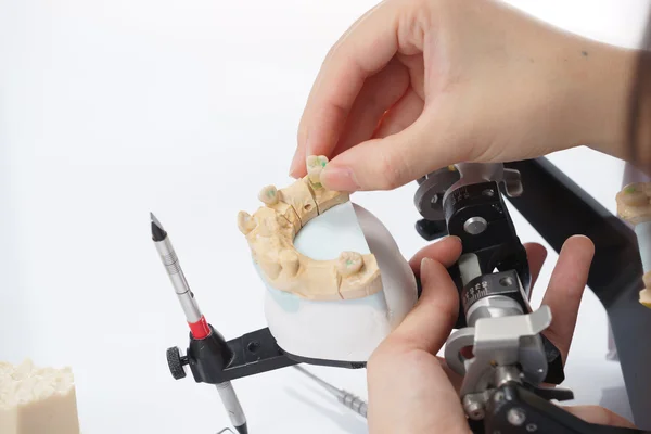 Técnico dental trabajando con articulador en laboratorio dental — Foto de Stock