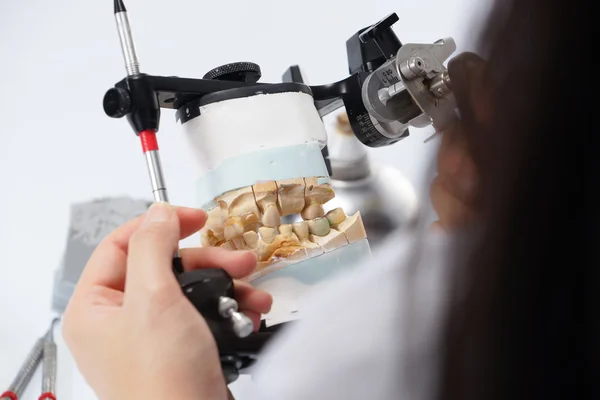 Técnico dental trabajando con articulador en laboratorio dental — Foto de Stock