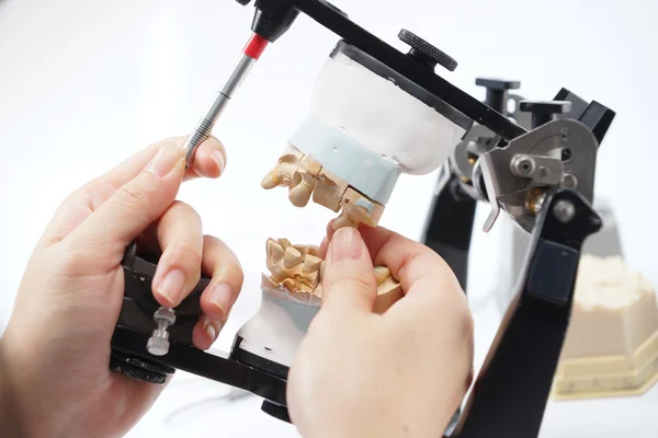 Técnico odontológico trabalhando com articulador em laboratório odontológico — Fotografia de Stock