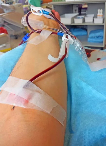 Doação de sangue no hospital — Fotografia de Stock