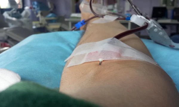 Bénévole lors du don de sang dans le lit d'hôpital — Photo