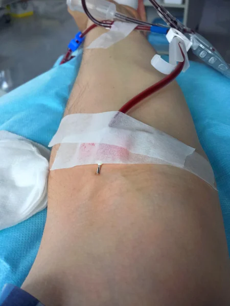 Joven durante la donación de sangre para el hospital —  Fotos de Stock