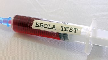 Tıbbi Laboratuar kan ebola virüsü ile enfekte kan 