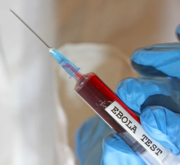 Läkare virolog vid testningen av ebola-virus — Stockfoto