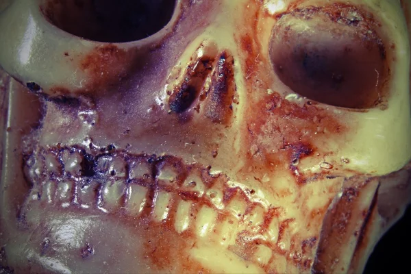 Cráneo con dientes y órbitas oculares — Foto de Stock