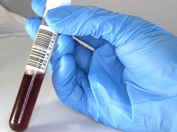 Tubo de teste de sangue de ébola em um laboratório médico — Fotografia de Stock
