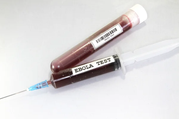 Siringa con sangue per effettuare i test del virus ebola — Foto Stock
