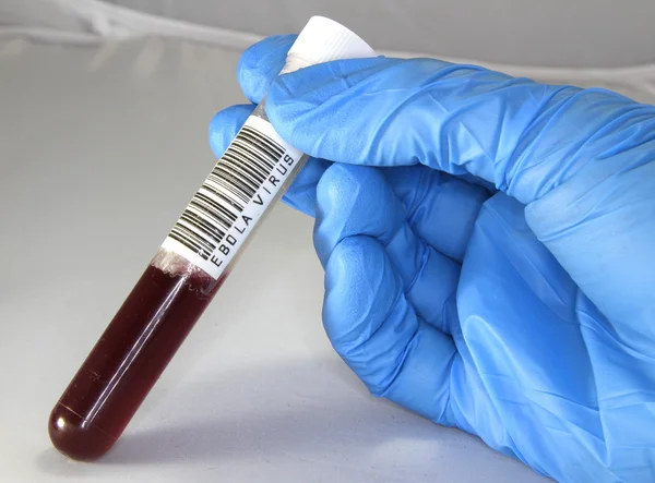 Doctor examines a tube with blood infected with ebola virus — Stock Photo, Image