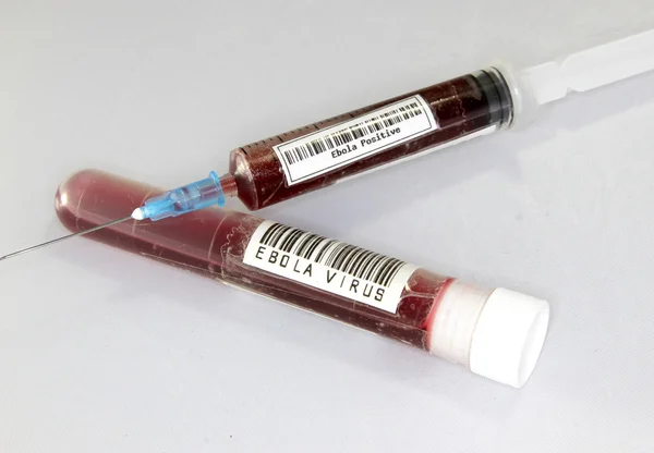 Jeringa con sangre para hacer las pruebas del virus del Ébola —  Fotos de Stock