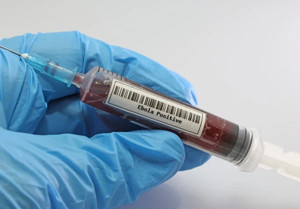 Blood sample of ebola virus on a syringe with the hand of the do — Stock Photo, Image