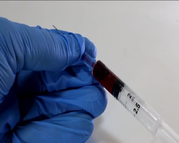 Доктор з рукавичкою і шприц з зразком крові — стокове відео