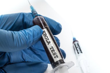 Doktor kan testleri için kan şırınga