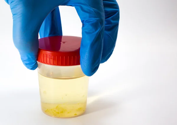 Läkare analytiker tar urinprov för urinanalys — Stockfoto
