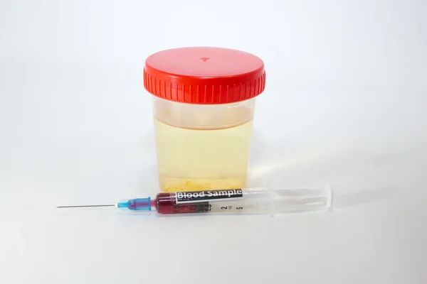 Spécimen avec urine pour analyse d'urine et seringue avec sang — Photo