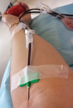ihtiyacınız olan hastanede kan nakli sırasında donör kan