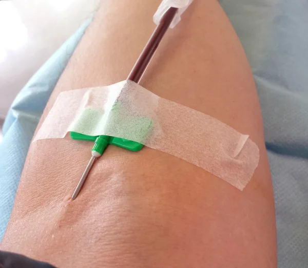 Donante de sangre durante la transfusión y donación de sangre — Foto de Stock