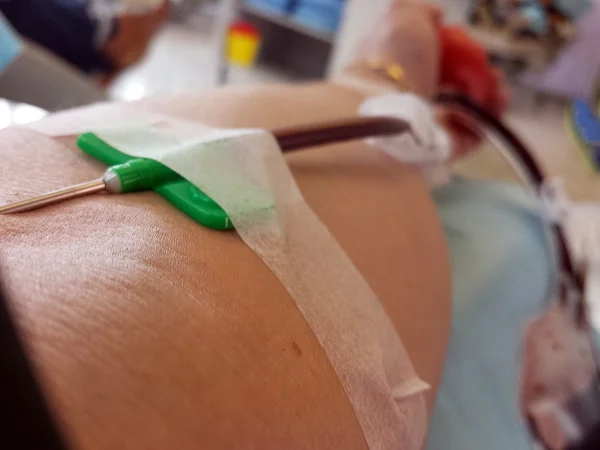 Frivillig under blodtransfusion på hospitalet - Stock-foto