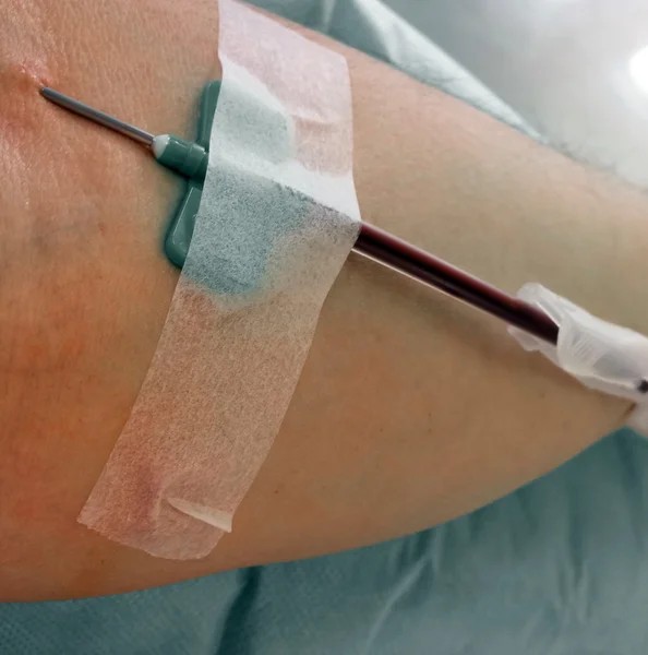 Aguja en el brazo del donante de sangre durante la donación de sangre —  Fotos de Stock