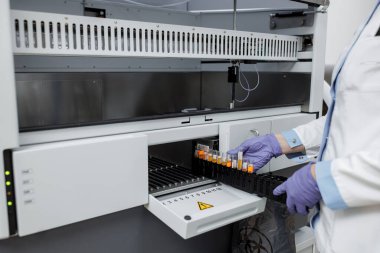 Testler için laboratuvar, doktor araştırma cihazına yüklüyor. Yüksek kalite fotoğraf