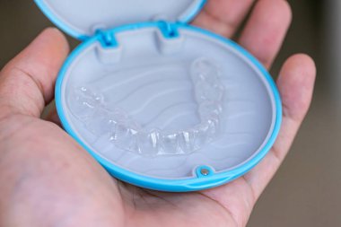 Ağızda beyaz bir arka planda ayar cihazı var. (geçersiz)