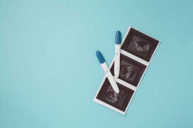 Mavi arka planda ultrason ve hamilelik testi. Pozitif hamilelik testi, mutlu annelik kavramı..