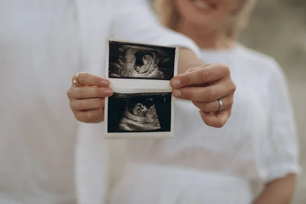 Gelukkige Jonge Zwangere Vrouw Met Ultrasone Scan Foto Lachende Europese — Stockfoto