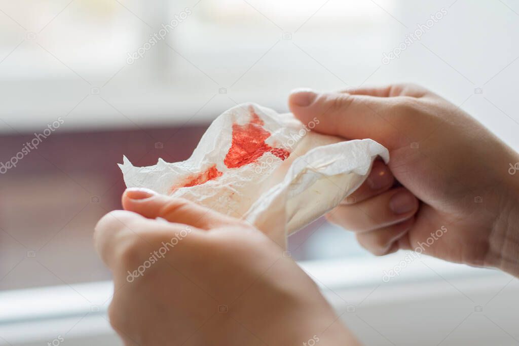 Photo of hands holding a napkin with blood