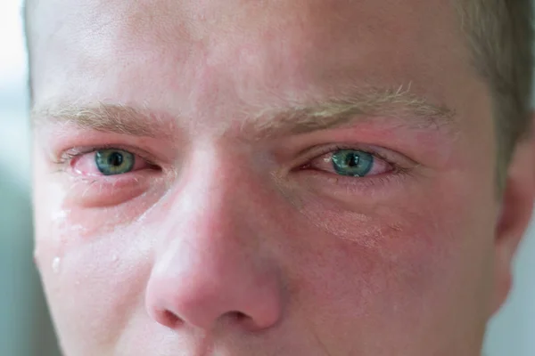 Rostro Hombre Llorando Con Ojos Azules — Foto de Stock