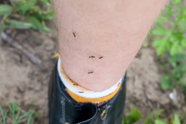 Varias Hormiguitas Pie Hombre Tema Las Picaduras Insectos Primer Plano —  Fotos de Stock