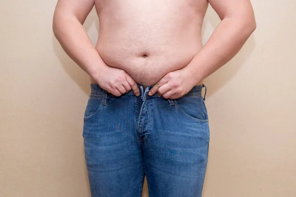 Uomo Che Indossa Jeans Blu Grasso Ventre Primo Piano Problema — Foto Stock