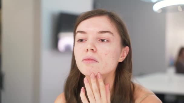 Girl with the problem of acne during puberty, looks at herself in the mirror. Close-up — Stock Video