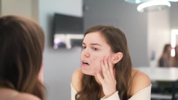 Ragazza con il problema dell'acne durante la pubertà, si guarda allo specchio. Primo piano — Video Stock