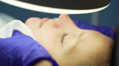 Doktor, kadının yüzündeki sivilceleri çıkartıyor. Eldivendeki eller steril süngerleri tutar ve hastaların cildindeki sivilceleri ve kirleri temizler. Cilt temizleme işlemi