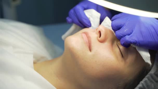 De dokter knijpt puistjes op het gezicht van een vrouw. Handen in handschoenen houden steriele sponzen vast en verwijderen vuil en puistjes op een schone huid. Huidreinigingsprocedure — Stockvideo