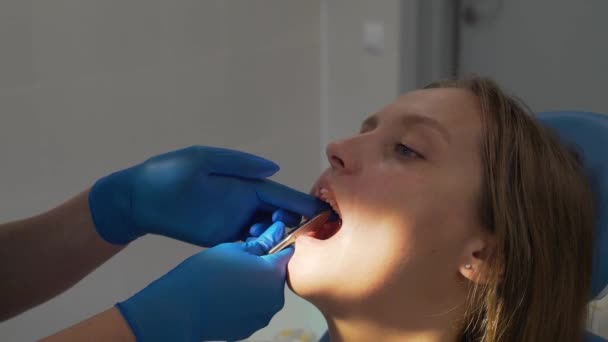 O ortodontista corta o arco do aparelho na boca do paciente. As mãos dos médicos estão em luvas de borracha. Nas mãos de uma ferramenta de metal. Ela morde o fio com cuidado. Aparelhos — Vídeo de Stock