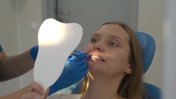 El ortodoncista coloca varillas de goma en los aparatos ortopédicos. La mujer sostiene el espejo delante de su cara y mira lo que el médico está haciendo. Las manos de los médicos están en guantes de goma. En manos de la herramienta. Tirantes — Vídeo de stock
