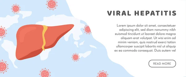 Концепция гепатита А, В, С, D, цирроза, мирового дня гепатита. Веб-сайт с картой мира и здоровой человеческой печенью атакован вирусом. Медицинский плакат вирусного гепатита. Вектор. — стоковый вектор