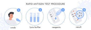 Covid-19 Hızlı Antijen test prosedürü Infographic. Bir doktor erkek hastadan burun çubuğu alır. Coronavirus numunesini lisis tamponunda değiş tokuş eder, reaktörlerle soyar ve antijen molekülleriyle sonuçlanır. Vektör.