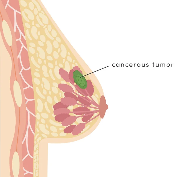 Premium Vector  Female chest anatomy mammary gland duct and lobular  structure