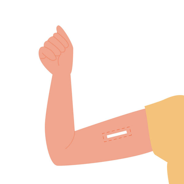 Метод контрацепции. Векторная плоская женская рука с вставленным контрацептивным имплантатом. Контроль рождаемости для женщин и профилактика беременности. Иллюстрация.