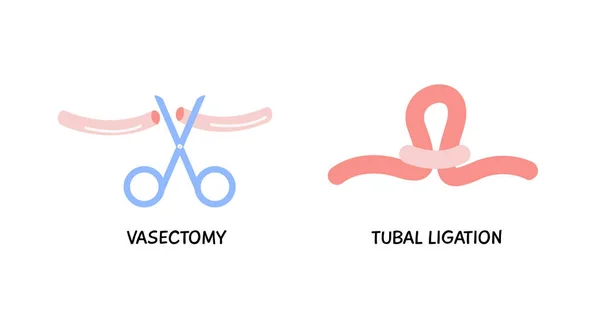 Vasektomie Mužský Nebo Ženský Koncept Sterilizace Tubal Ligation Barevný Plochý — Stockový vektor