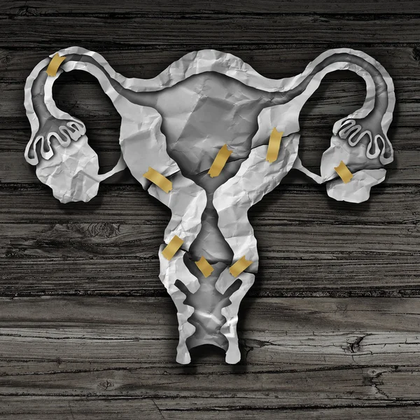 Uterus Surgery Concept — Stock Photo, Image