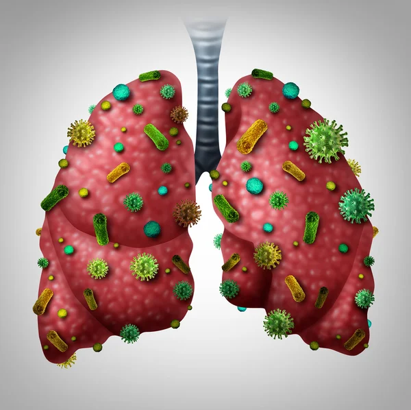 Símbolo de infección por neumonía —  Fotos de Stock