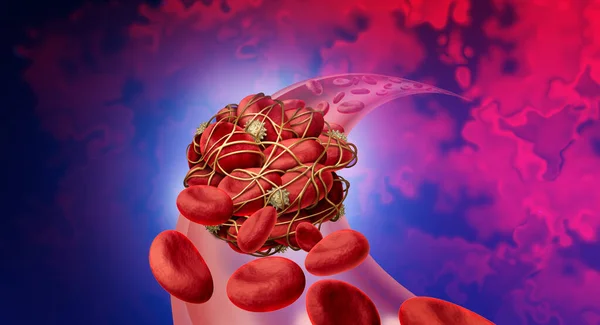 血液凝块健康风险或血栓形成医学图解符号是指一组人的血细胞被粘液血小板和纤维蛋白聚集在一起 作为动脉或静脉阻塞的三维表现 — 图库照片