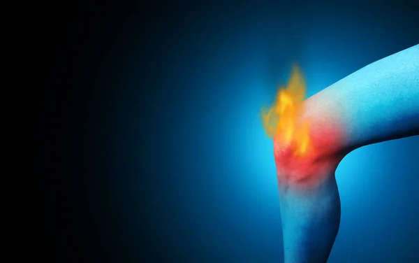 青を基調とした3Dイラストスタイルで負傷や作業事故による慢性燃焼性疼痛炎症としての痛み膝関節痛や脚の損傷 — ストック写真