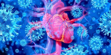 Viral myocarditis or virus infection of the human heart resulting in inflammation  of the cardiac circulatory organ with 3D illustration elements. clipart